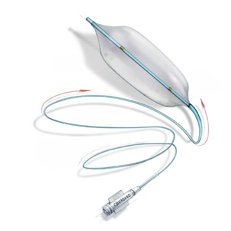 Balt Cristals valvuloplasty balloons interventional cardiology Australia